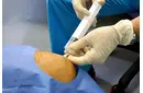 Eklem Sıvısı Özellikleri ve Faydaları Nelerdir?